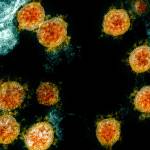 This electron microscope image made available and color-enhanced by the National Institute of Allergy and Infectious Diseases Integrated Research Facility in Fort Detrick, Md., shows Novel Coronavirus SARS-CoV-2 virus particles, orange, isolated from a patient. (NIAID/National Institutes of Health via AP)